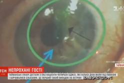 Тайваньские врачи достали с глаза пациентки четырех живых пчел (видео)