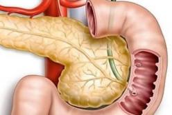 Вкусные продукты, в которые влюблена ваша поджелудочная железа (видео)