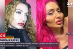 Украинка прославилась в мире из-за больших скул (видео)
