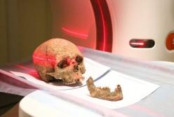 В Тернополе с помощью КТ изучают череп возрастом три тысячи лет (видео)