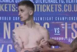 Британский боксер потерял сознание на церемонии взвешивания (видео)