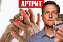 Найкращий вітамін від артриту: не D, а B3