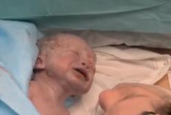 Впервые в мире ребенок родился из матки, пересаженной от умершей женщины (видео) 