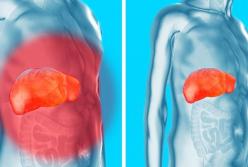 Как мягко и эффективно вывести токсины из организма (видео)