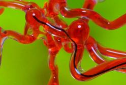 Создали робота-змею для лечения инсульта (видео)