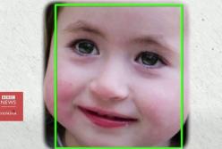 Новая уникальная технология распознавания генетических болезней по фотографиям (видео)