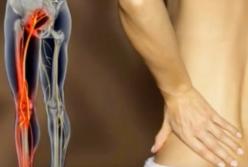 Как приструнить боль в спине: всего одно простое упражнение (видео)