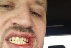 В Киеве жестоко избили ветерана АТО (видео)