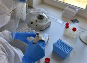 Коронавирус разрабатывали как вакцину против СПИДа: известный ученый сделал открытие о Covid-19