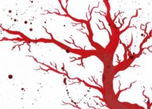 Две тонны крови