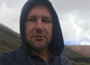 Чтобы ампутировать руку - заходите в парикмахерскую: откуда взялись цирюльники-хирурги?