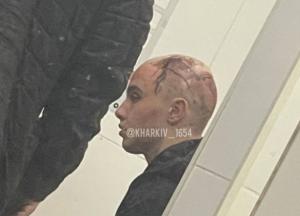 Смертельное ДТП в Харькове: подробности о родителях подростка (видео)