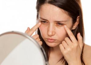 Как избавиться от мешков и темных кругов под глазами