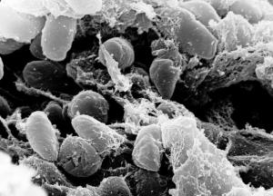 Грозит ли бубонная чума и свиной грипп Украине: блиц с эпидемиологом