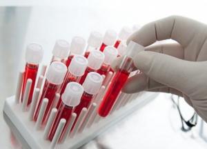 Умрете ли вы в ближайшие 10 лет: ученые разработали новый анализ крови