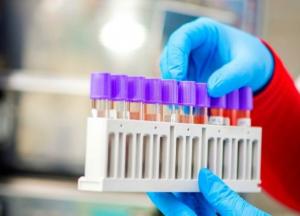 Тест на антитела: как оценить иммунный ответ COVID-19?