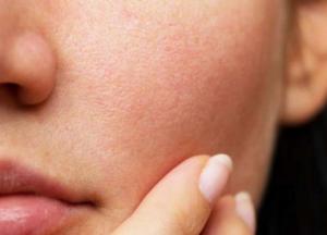 3 эффективных маски от расширенных пор