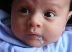 Срыгивание у ребенка: когда стоит обратиться к врачу?