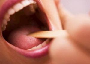 Как защитить себя от дифтерии