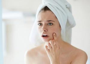 ​Почему появляется угревая сыпь?