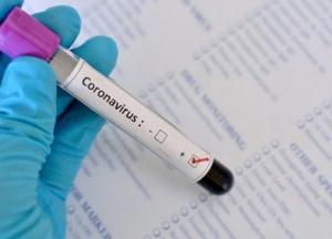 Почему в Украине мало тестов на коронавирус