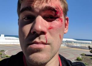 Владелец интернет-магазина избил клиента, которому продали ворованный планшет