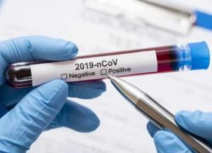 Болеть будем волнами: когда человечество сможет укротить коронавирус