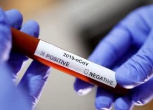 Каким тестам на коронавирус можно доверять?