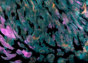 Новое изобретение микроскопа