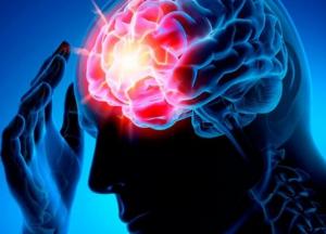 Врачи назвали главный симптом инсульта