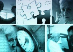 Медики назвали причины, приводящие к развитию слабоумия в более молодом возрасте