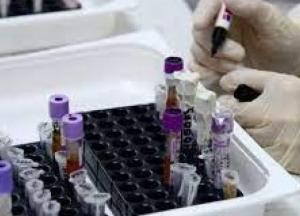 В Украине 1581 новый случай коронавируса