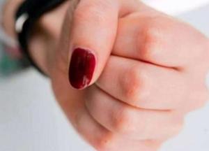 На Кировоградщине женщина до смерти избила бывшую свекровь 