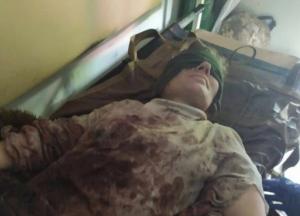 На линии разграничения в зоне ООС женщине оторвало ногу