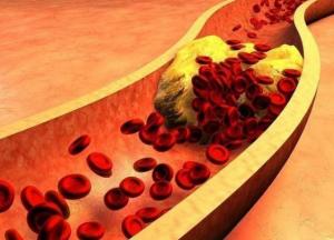 Врачи назвали продукт, который поможет очистить сосуды от холестерина