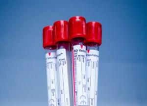 Медики назвали самую опасную группу крови