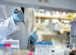 В Украине зафиксировано уже более 10 тыс. случаев COVID-19, из них 261 летальный