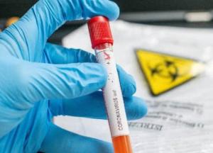 Первый случай коронавируса зафиксировали в Хмельницком