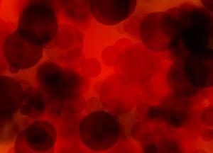 Медики назвали симптомы опасного для жизни сгустка крови