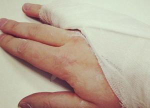 В Киеве пьяный мужчина сломал палец полицейскому