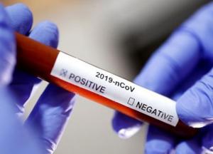 В Украине подтверждено уже 26 случаев инфицирования коронавирусом
