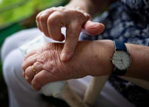 Медики назвали симптомы развивающегося в организме артрита