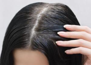 Ученые назвали причины появления ранней седины