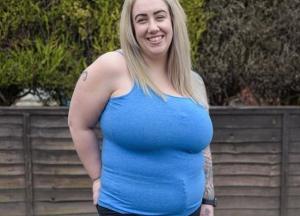 Большая грудь испортила британке жизнь (фото)