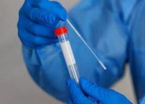 В Украине 763 новых случая коронавируса