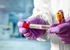 В Украине 8832 новых случая коронавируса