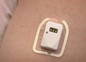 Никаких иголок: создан пластырь, который измеряет уровень сахара в крови