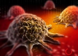 Врачи назвали вредные привычки, провоцирующие онкологию