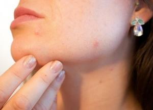 Эксперты назвали пищевые привычки, которые вредят коже