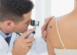 Ученые объяснили появление родинок на определенных частях тела 